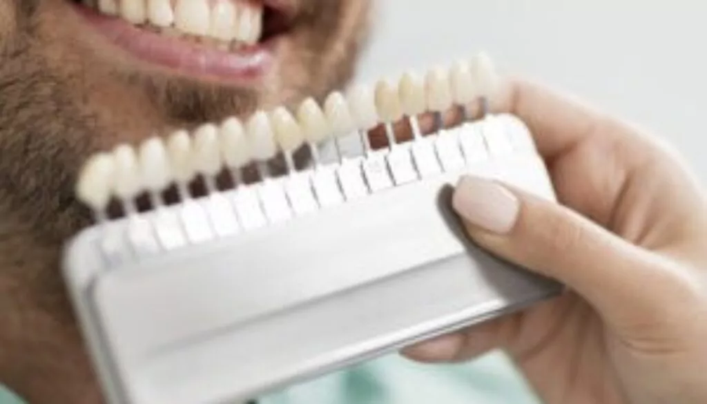 licówki_blog licówki_blog