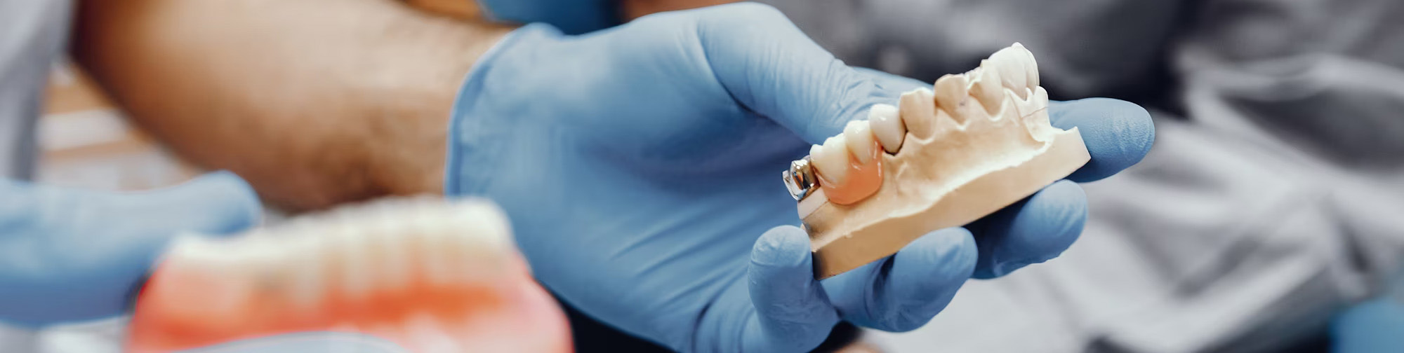 Dentysta pokazuje przebieg leczenia kanałowego u dr Herckiej 