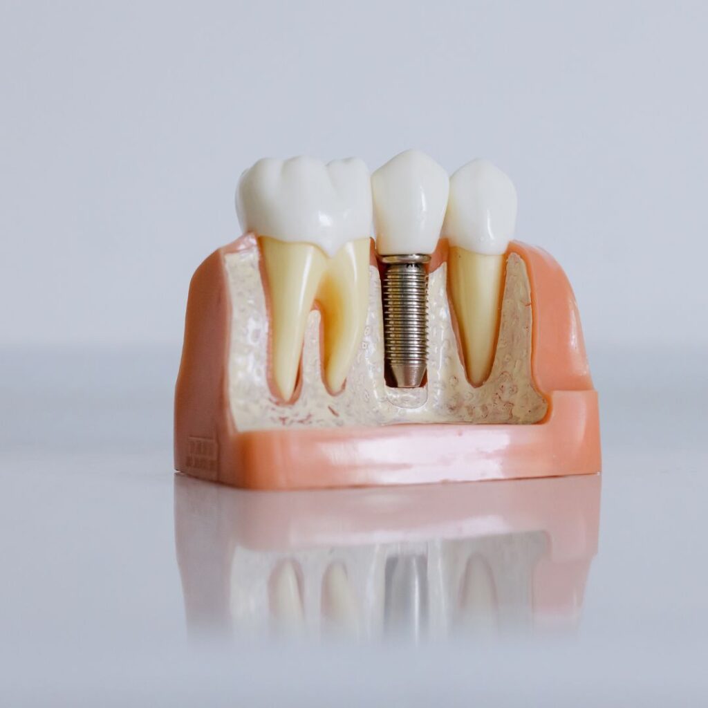 implantologia stomatologia dr hercka 