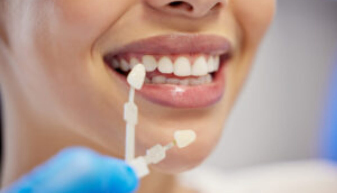 dentist-cleaning-dental-procedure-toothache-clinic-health-treatment-mouth-teeth-whitening-face-person-with-torque-wrench-machine-orthodontics-oral-care-veneers