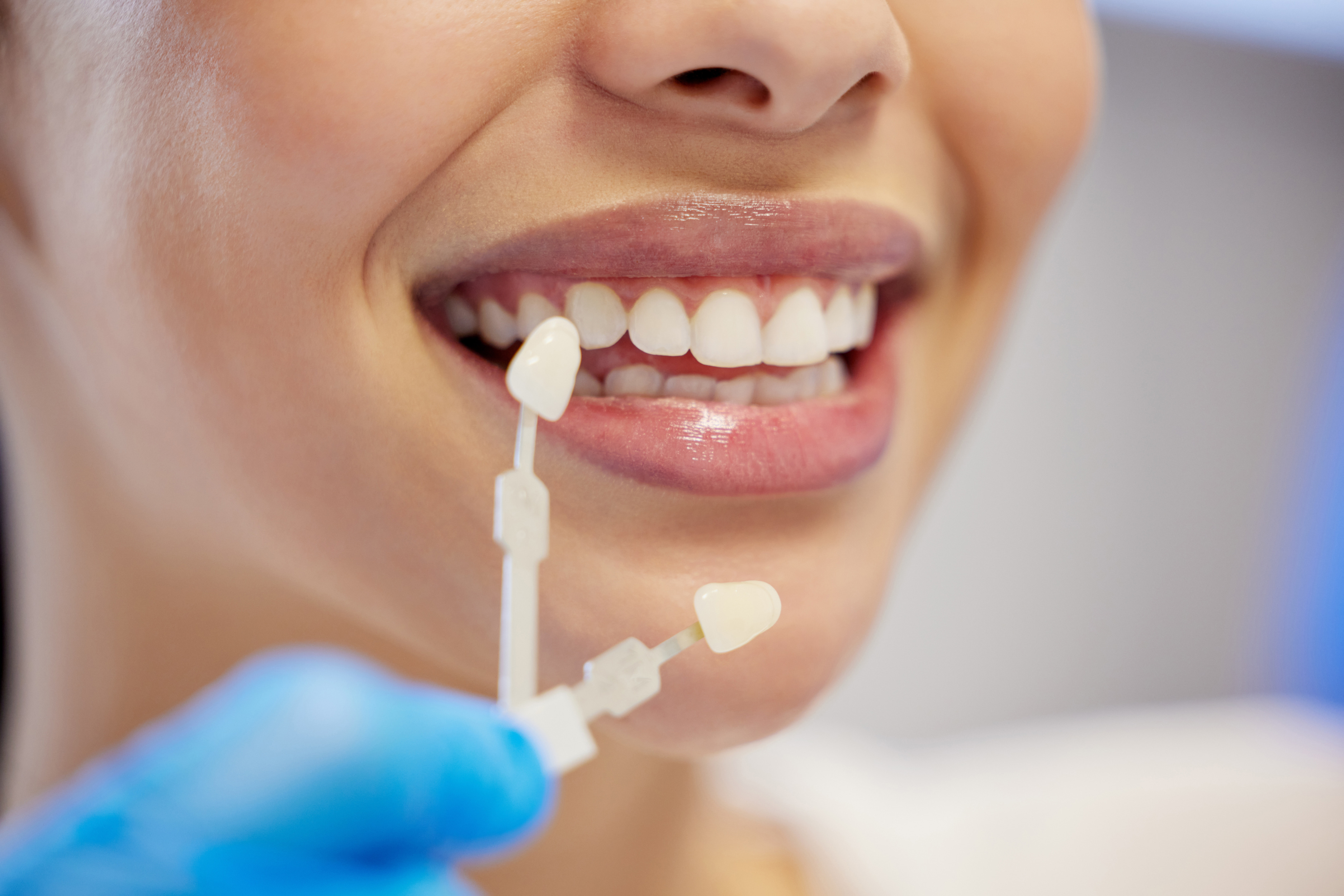 dentist-cleaning-dental-procedure-toothache-clinic-health-treatment-mouth-teeth-whitening-face-person-with-torque-wrench-machine-orthodontics-oral-care-veneers